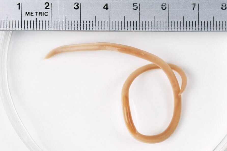 Το Ascaris είναι ένα στρογγυλό σκουλήκι που ζει στο ανθρώπινο σώμα
